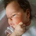 Common Rashes in Children: Identification and Management