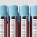 Direct-to-Consumer Blood Testing: Empowerment or Peril?