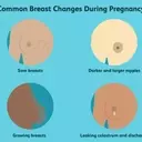 Understanding Breast Transformations During Pregnancy: A Comprehensive Guide