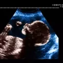 The Art and Impact of Pregnancy Nicknames