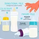 Understanding the Diverse Hues of Breast Milk: A Comprehensive Guide