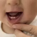 Baby Teeth: Untangling the Impact of Toxic Metals on Brain Development