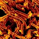 Revolutionizing Tuberculosis Diagnostics: A New Era of Swift and Accurate Detection