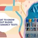 Understanding the Accuracy and Nuances of Blood Pregnancy Tests