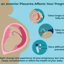 Understanding Anterior Placenta During Pregnancy