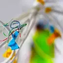 Nano Dimension Updates on Infinite Epigenetics Merger
