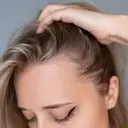 Veradermics: Pioneer in Pattern Hair Loss Treatment with Promising Oral Minoxidil