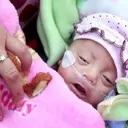 The Amazing Resilience of Premature Babies: Stories of Survival and Hope