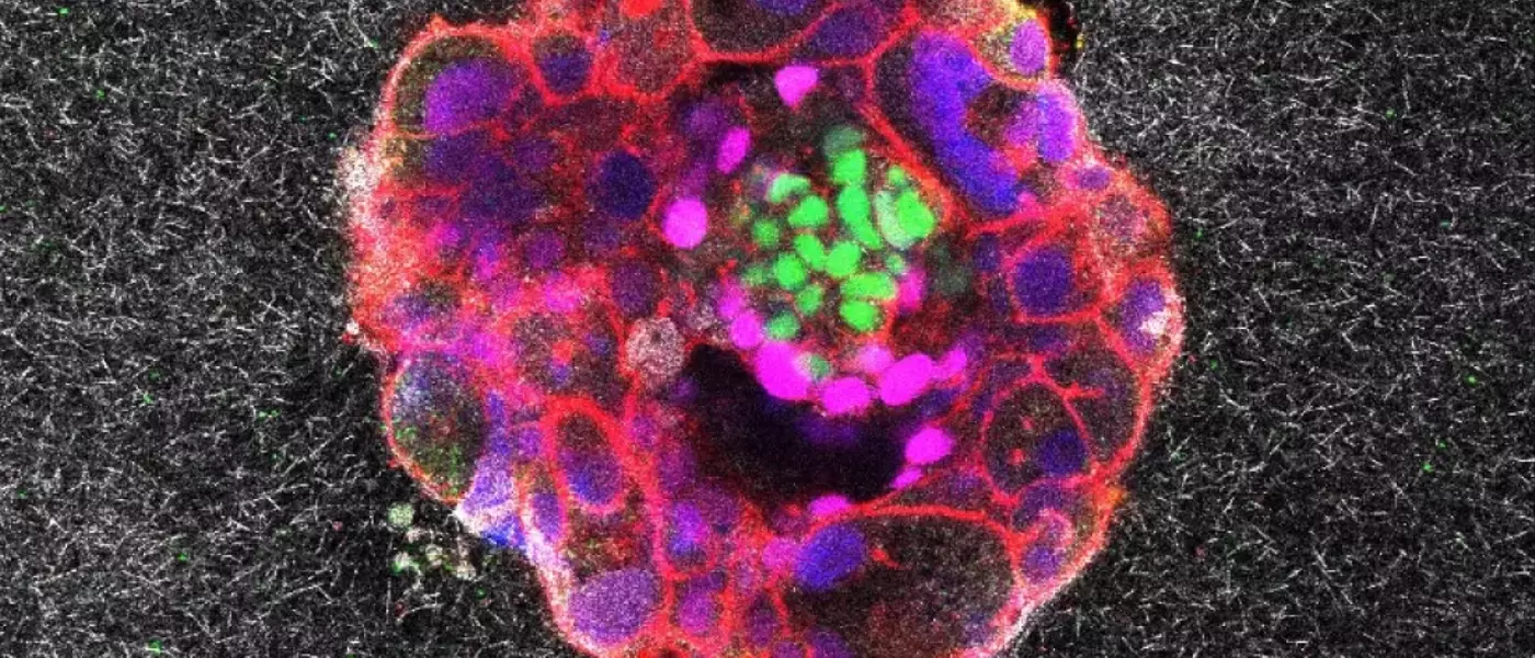 Unveiling Life's First Steps: Real-Time Embryo Implantation Captured