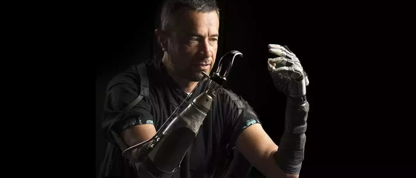 Bridging the Gap: AI Enhances Bionic Hand Functionality for Amputees