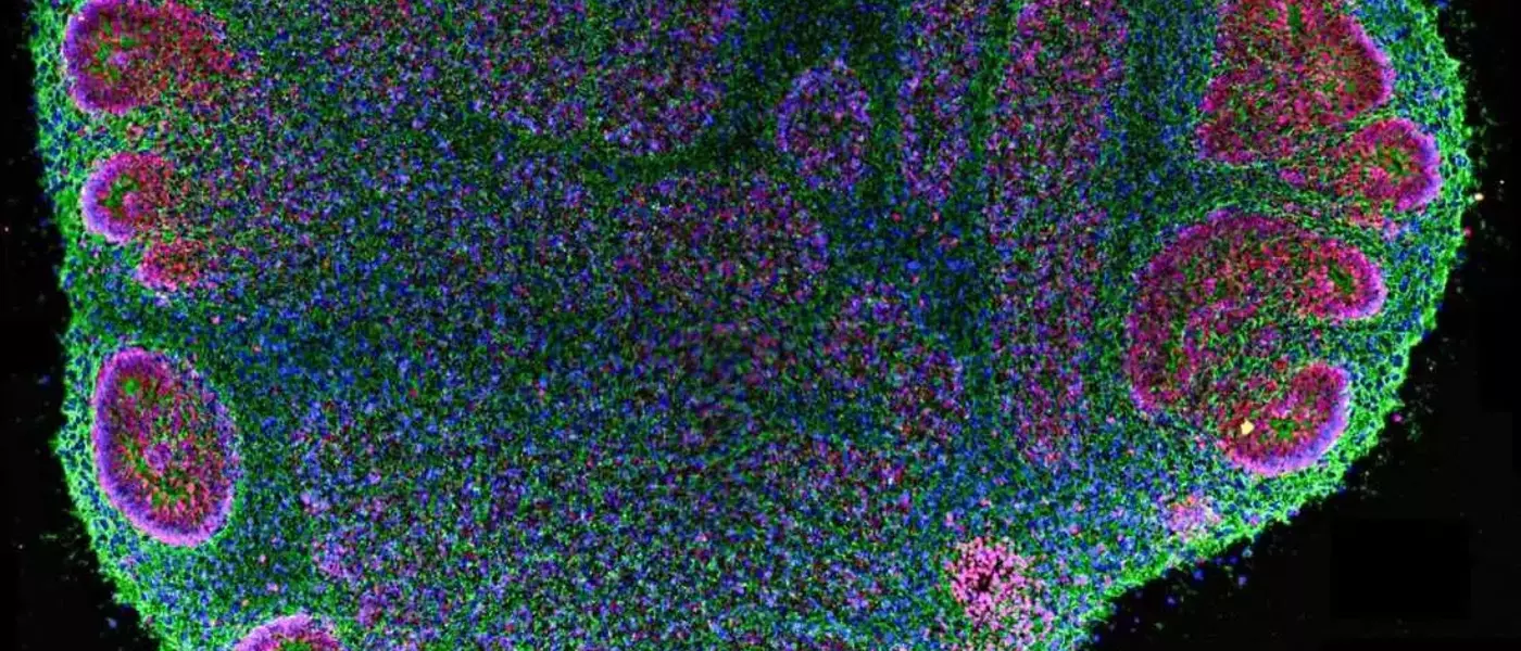 Brain Organoids: Advancements and Ethical Complexities in Neural Research