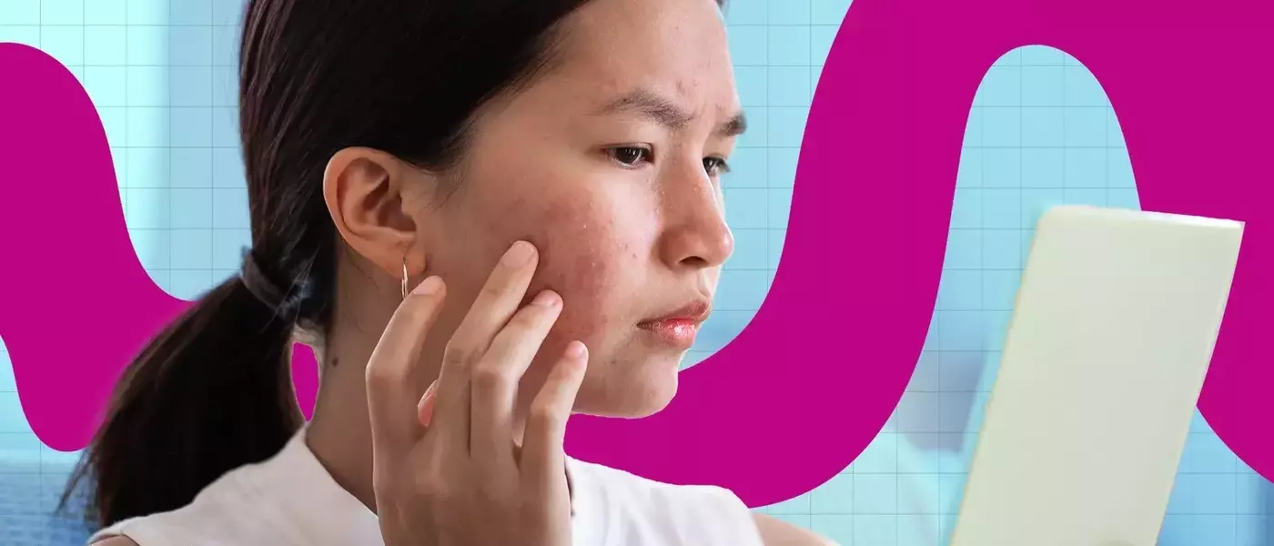 The Intricate Link Between Gut Health and Skin Radiance