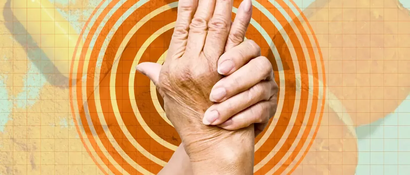 Dietary Strategies to Mitigate Arthritis Flare-Ups