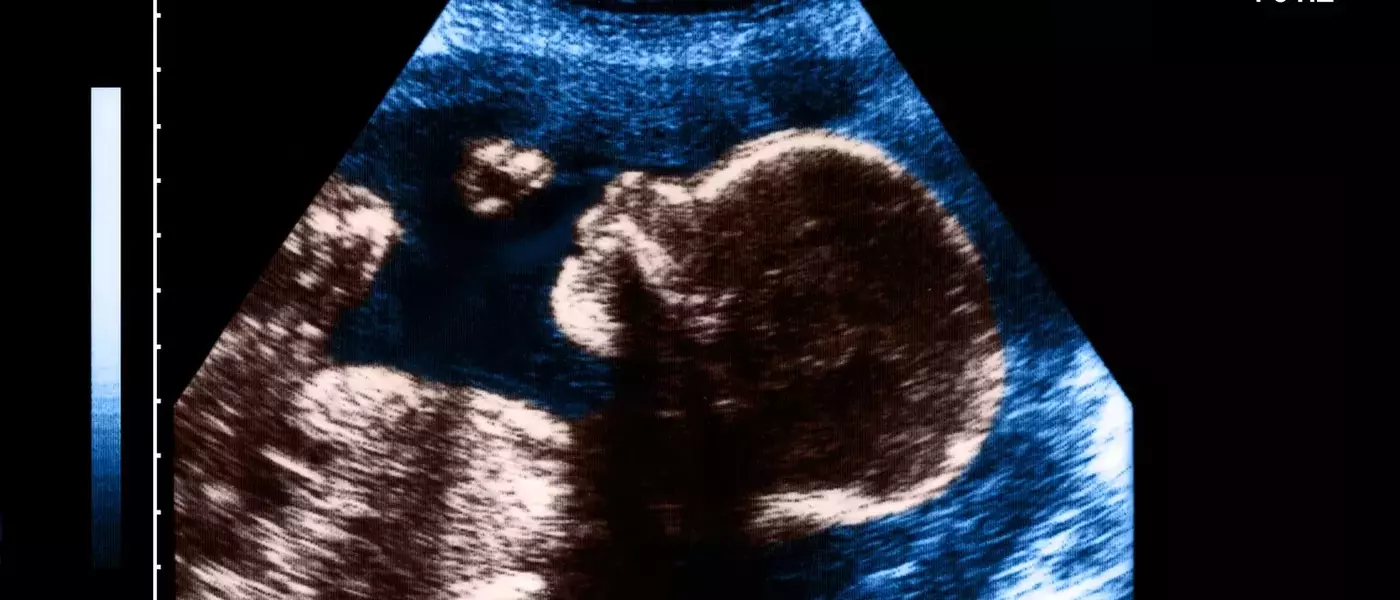 The Art and Impact of Pregnancy Nicknames