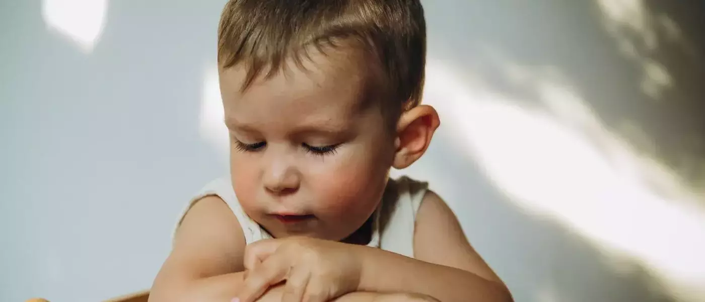 Understanding and Managing Eczema in Children