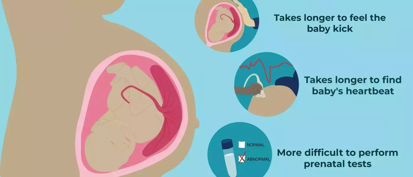 Understanding Anterior Placenta During Pregnancy