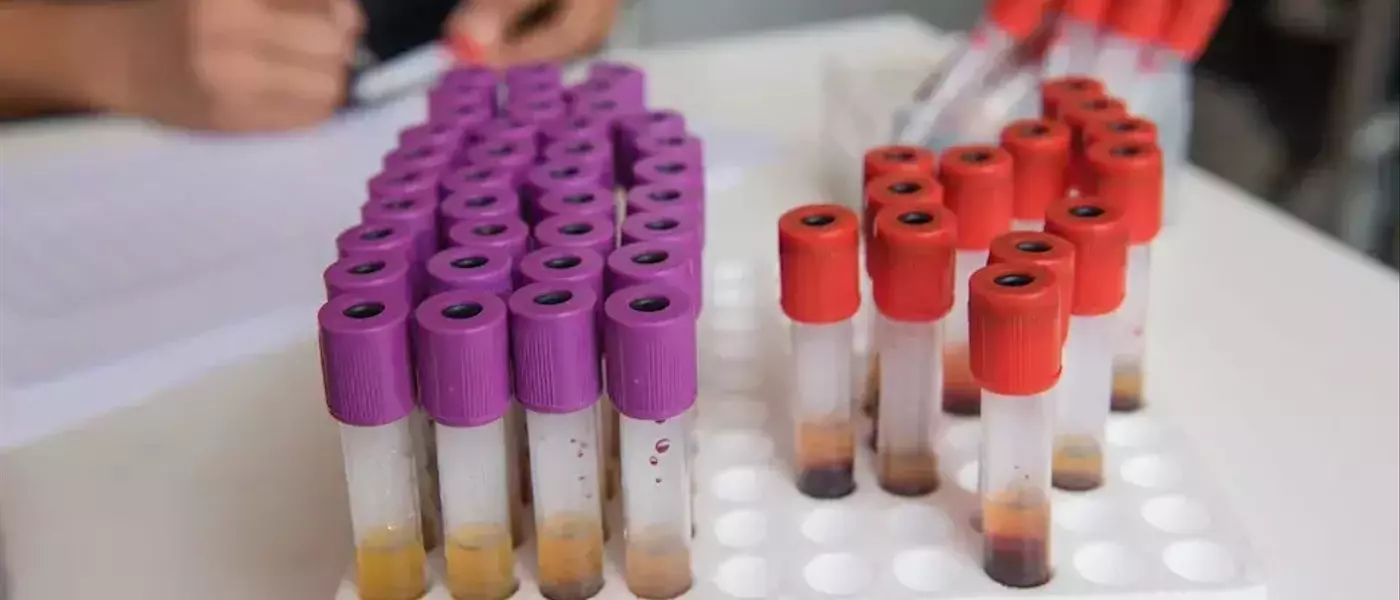 Omeros (OMER) Stock: Potential for Over 200% Return
