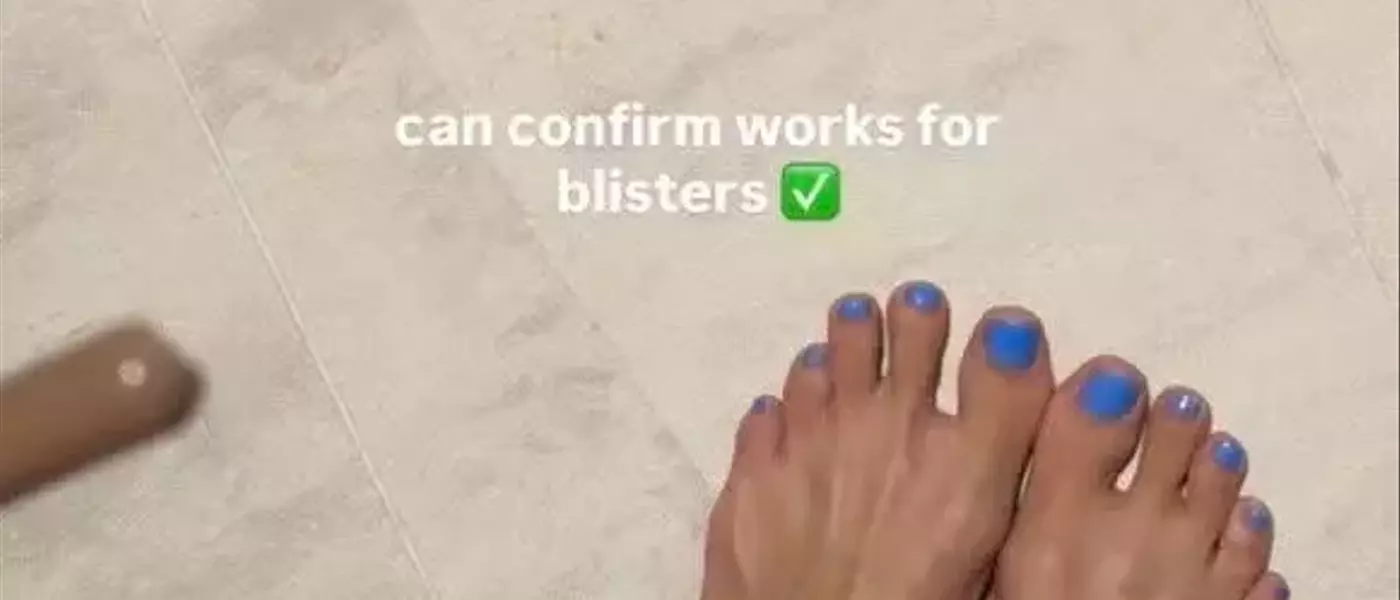 Hailey Bieber's Unexpected Blister Remedy: Pimple Patches