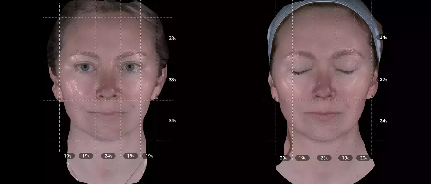 Aesthetic Enhancement: Exploring the Efficacy of XERF for Pre-Wedding Skin Rejuvenation