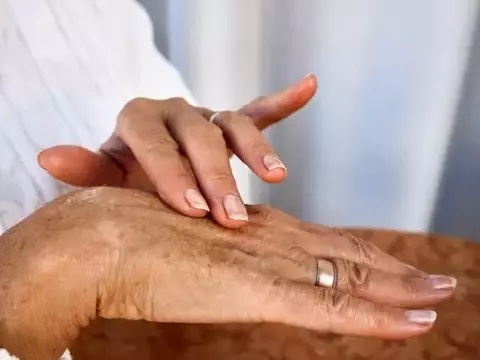 Reversing the Clock: A Dermatologist's Guide to Youthful Hands with Retinol